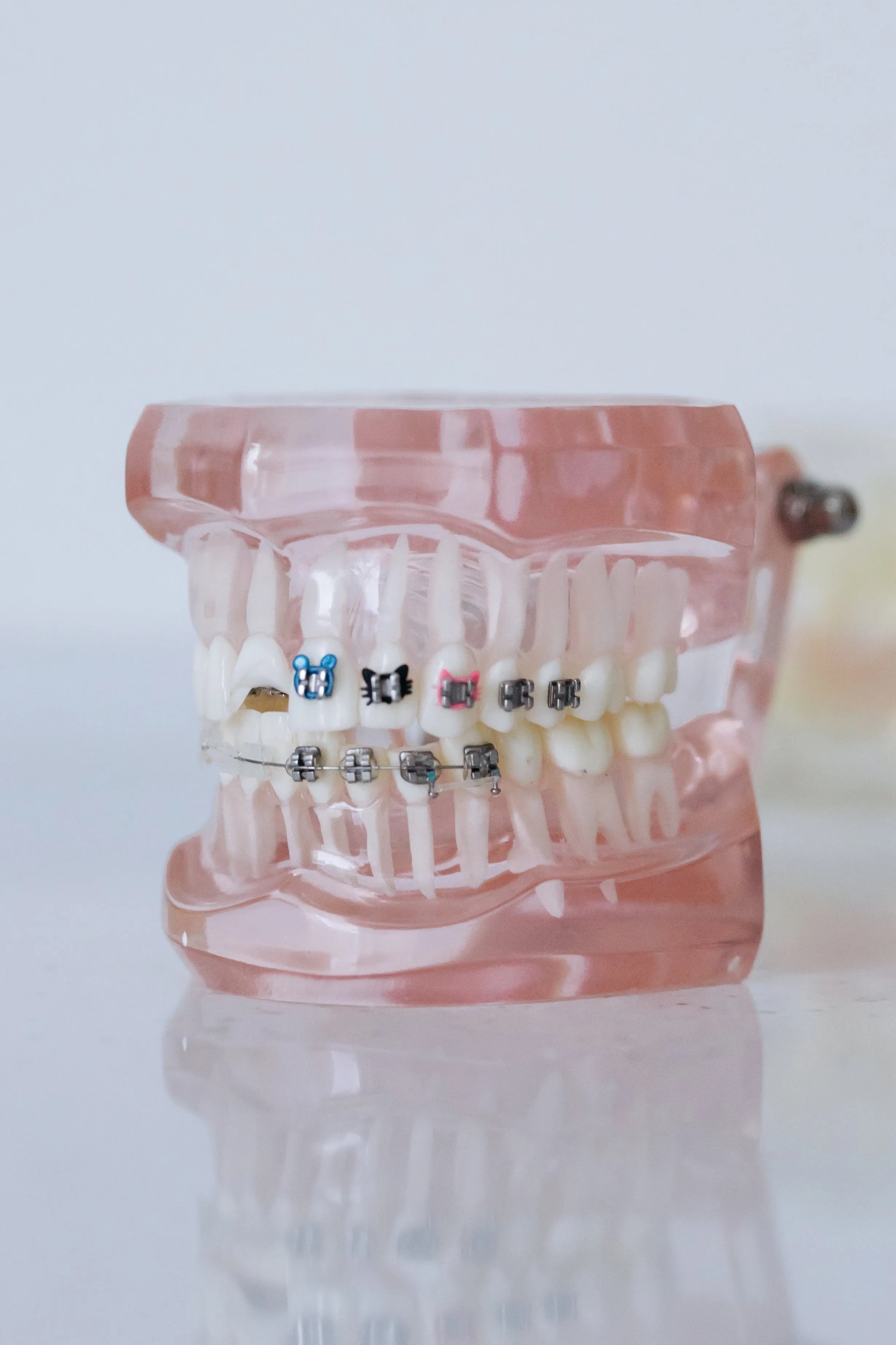 how much do braces cost